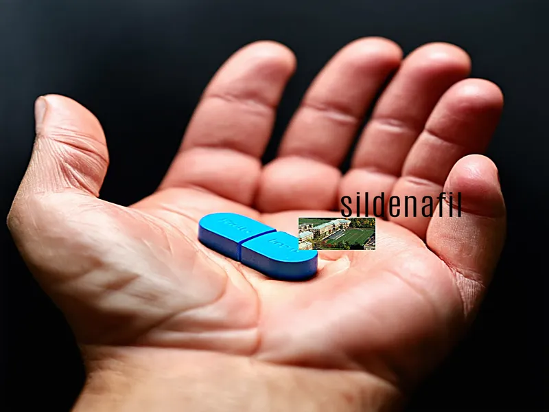 Sildenafil teva 50 mg pris