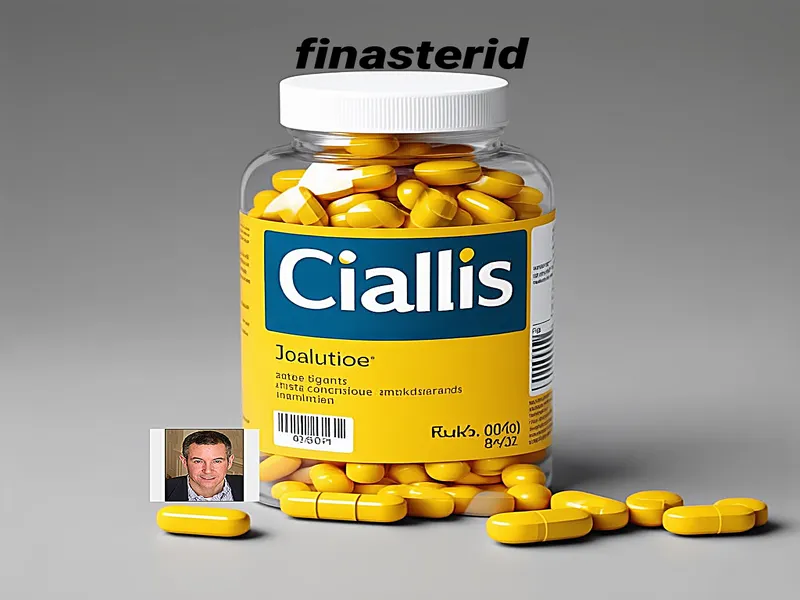 Finasteride propecia prezzo